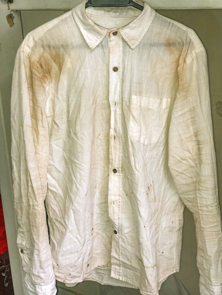 lavagem de camisa antes e depois camisa social suja antes de ir para a lavanderia na barra da tijuca lavagem de camisa social